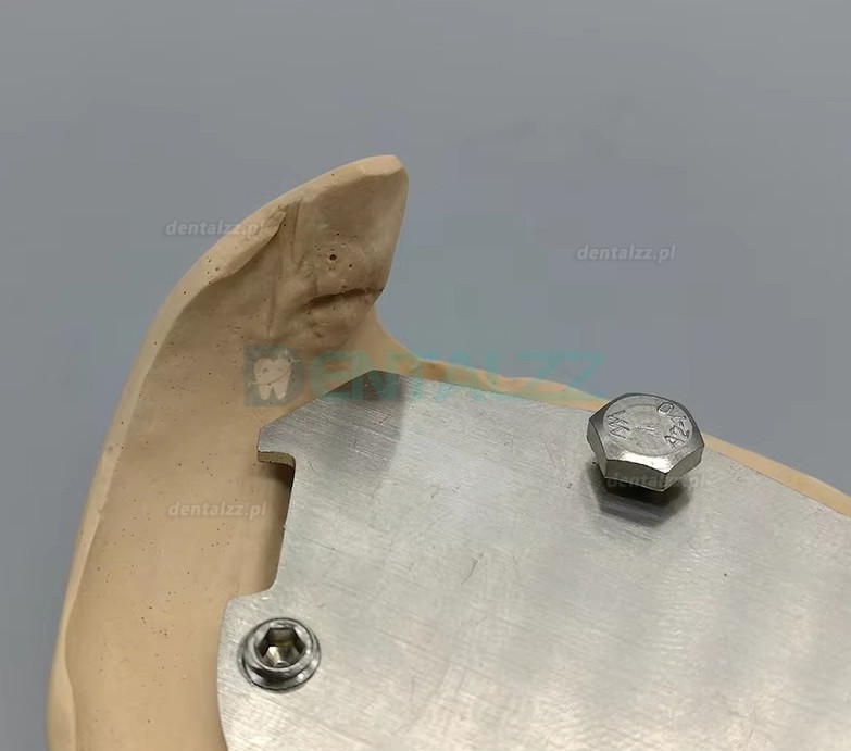 Rejestrator Pionowej Relacji Centralnej z Trasowaniem Łuku Gotyckiego dla Pacjent&oacute;w Bezzębnych